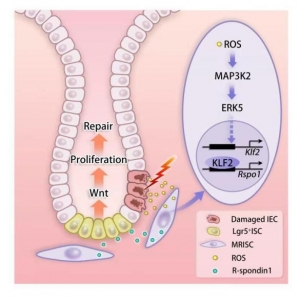 科学家发现新型肠道间质细胞MRISC，揭示其在肠道损伤过程中促进组织修复的机制 ... .. ...