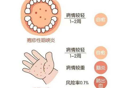 近期高发！“疱疹性咽峡炎”来势汹汹